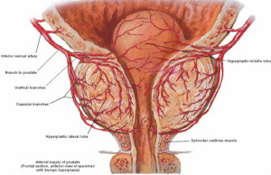 BPH_arteries